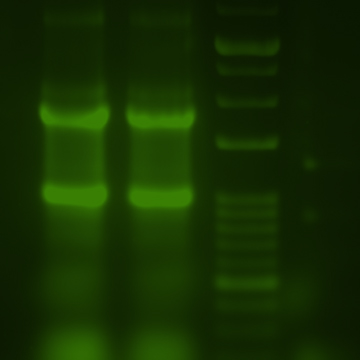 EzPreStain DNA&RNAでRNAを染色したパターン