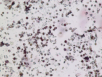 CytoWatcher__large.jpg